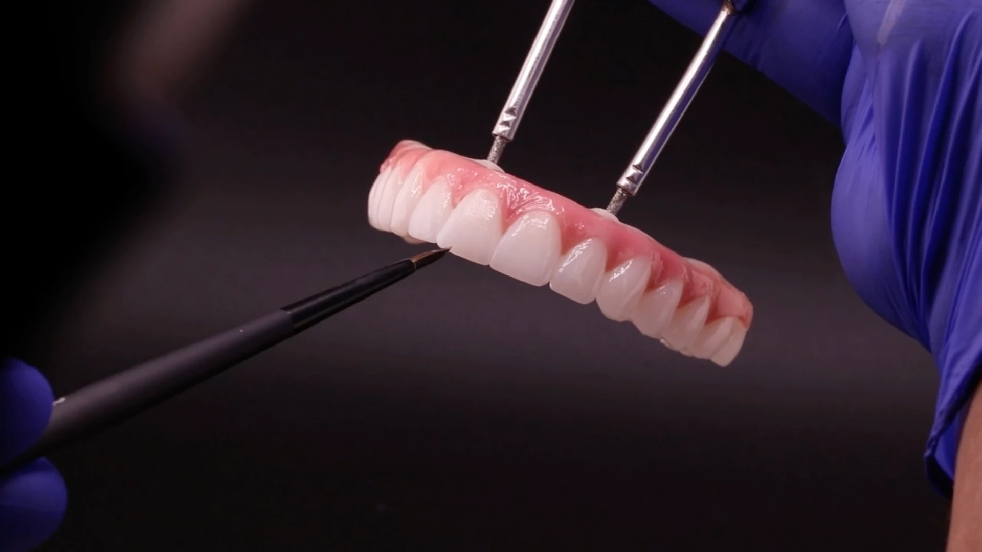 dental technician preparing a final all-on-4 dental implant bridge