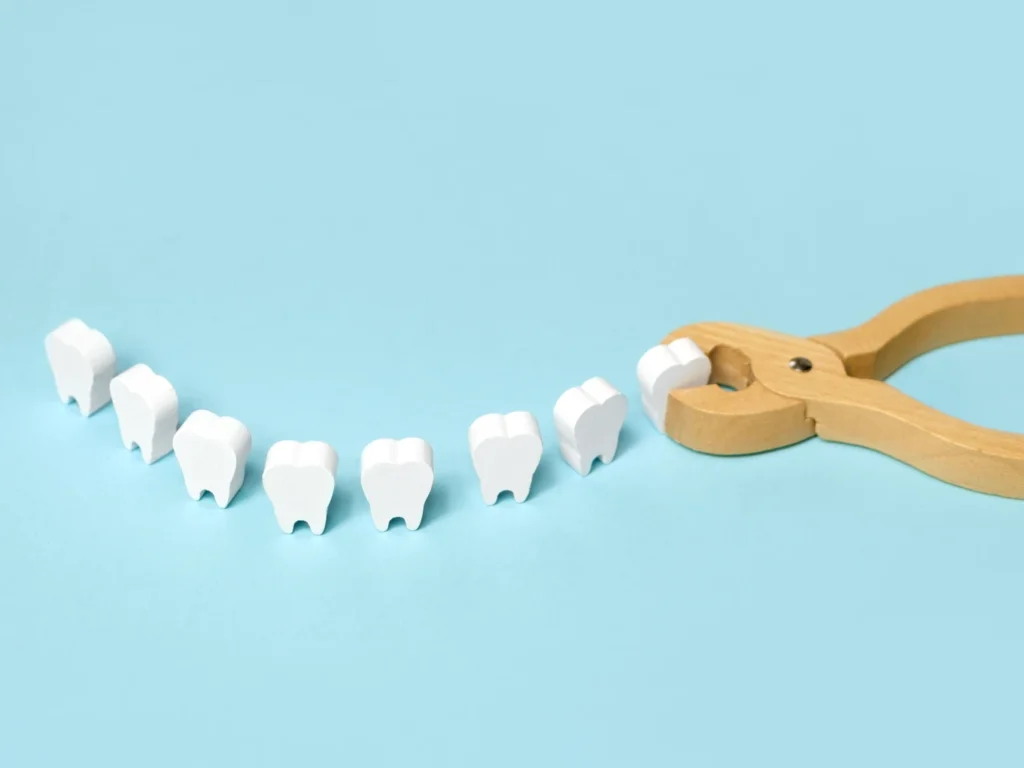 emergency tooth extraction Tacoma, WA