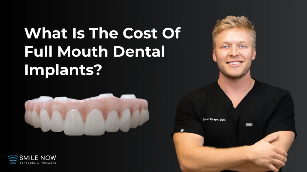 Video thumbnail about the cost of full mouth dental implants