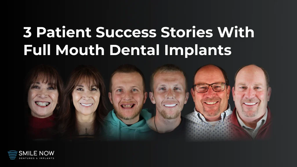 Video thumbnail for 3 patient success stories with full mouth dental implants