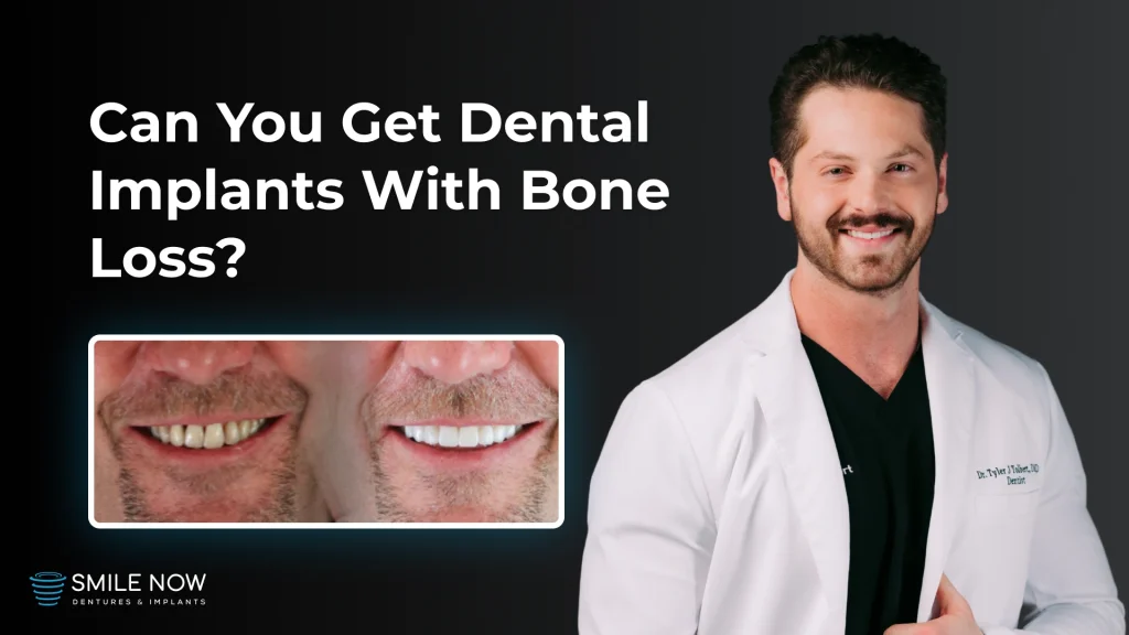 Video thumbnail about getting dental implants for bone loss in teeth