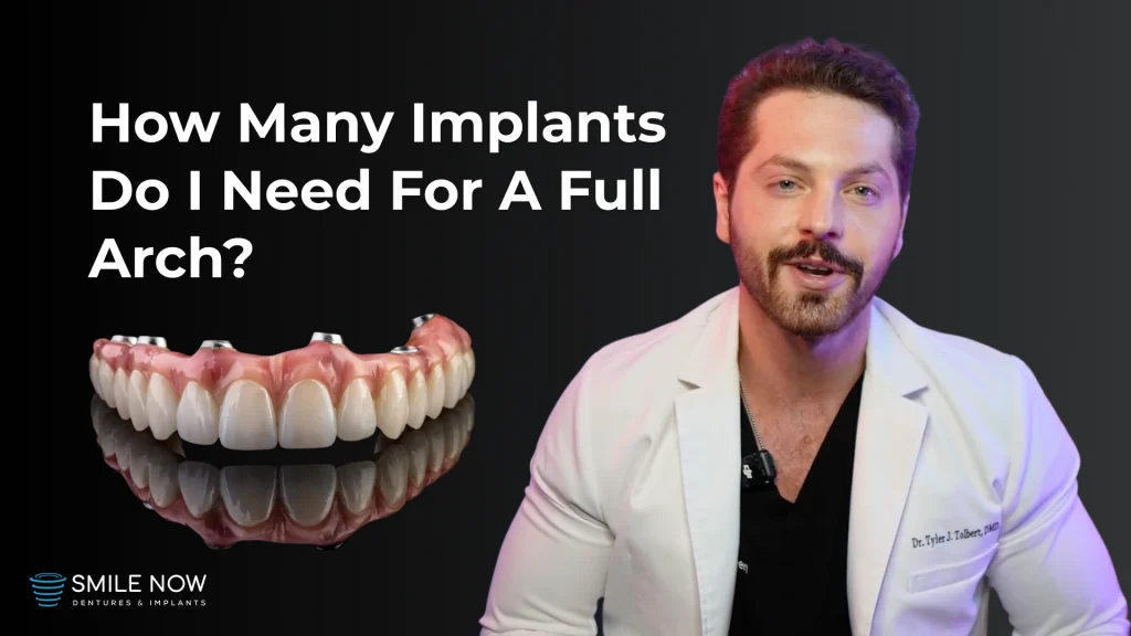 Video thumbnail for "How many implants do I need for a full arch?" | full arch dental implants