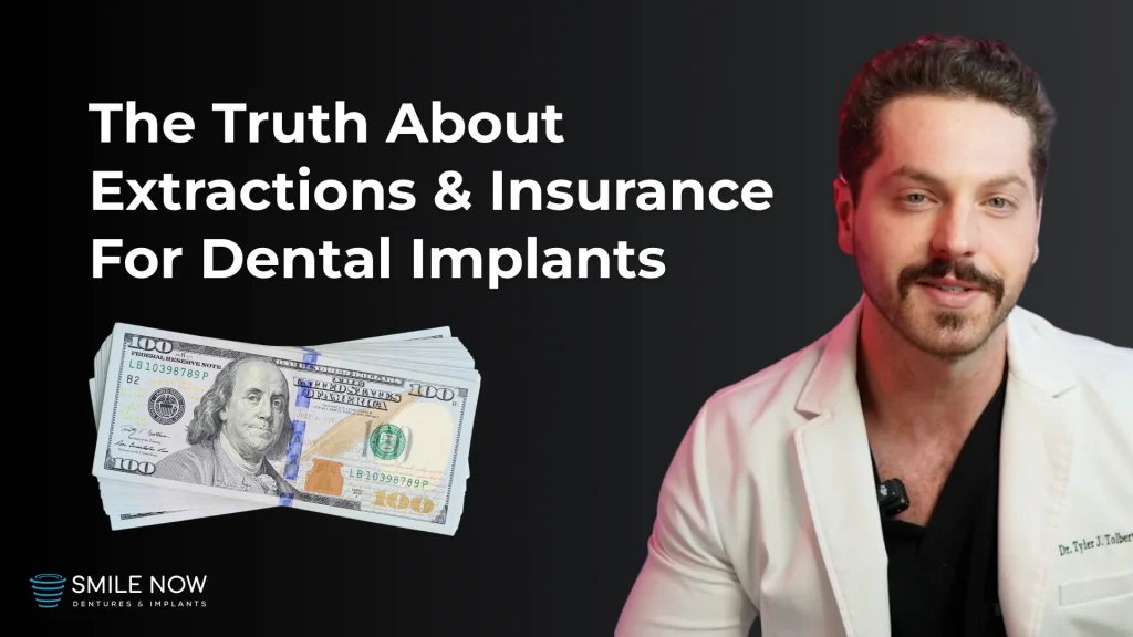 Does dental insurance cover implants? The truth about insurance coverage for extractions and implants